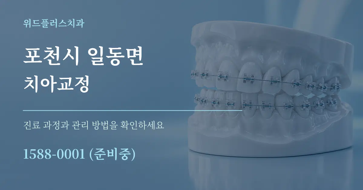 포천시 일동면 치아교정 작업 조건 안내 그래픽