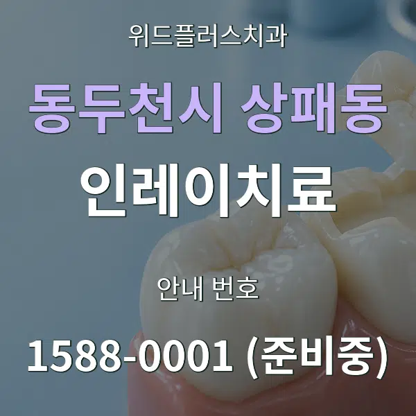 동두천시 상패동 인레이치료 대표 안내 그래픽