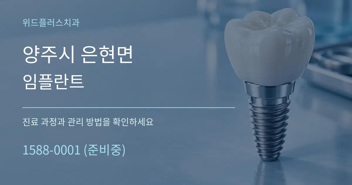 양주시 은현면 임플란트 서비스 이용 안내 그래픽