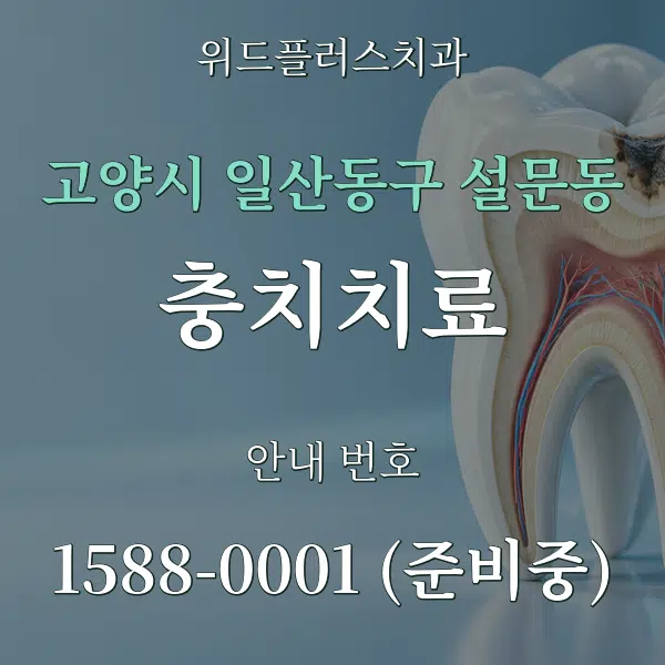 고양시 일산동구 설문동 충치치료 대표 안내 그래픽