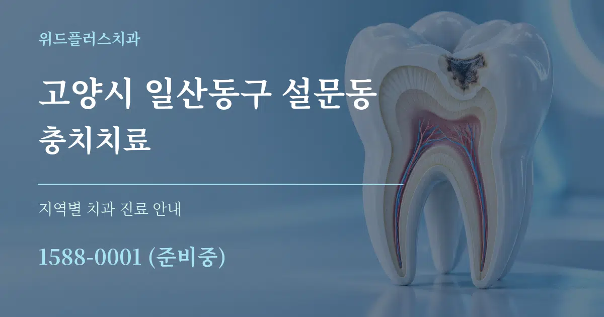 고양시 일산동구 설문동 충치치료 대표 안내 그래픽