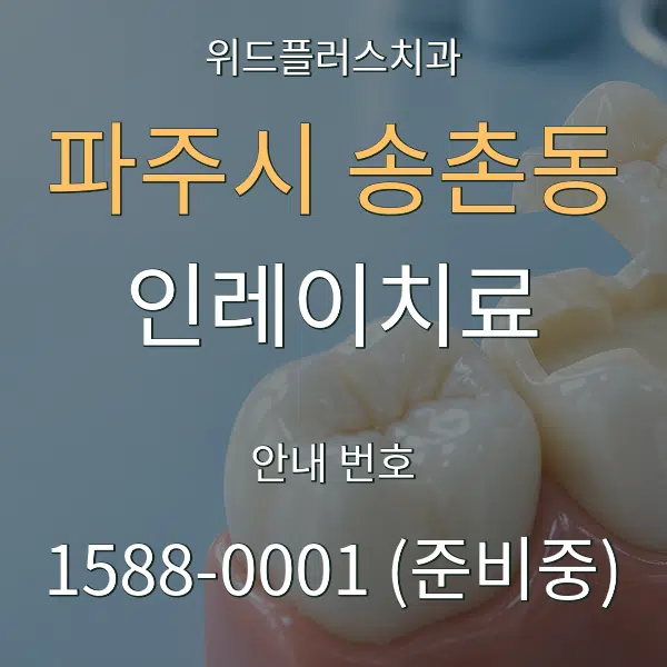 파주시 송촌동 인레이치료 대표 안내 그래픽