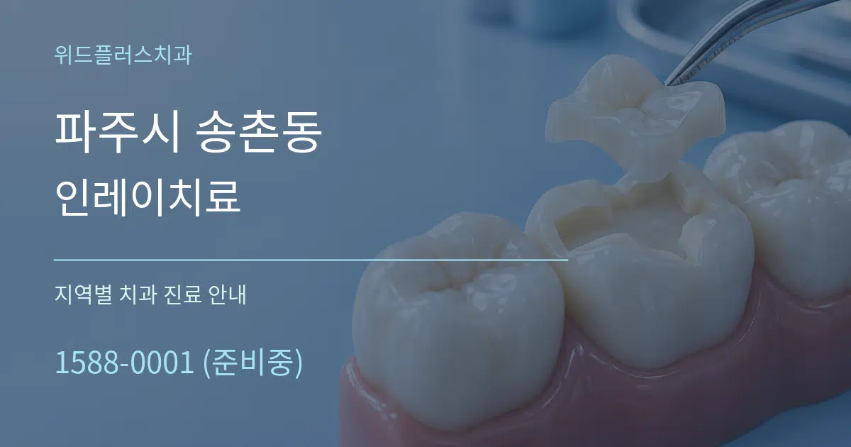 파주시 송촌동 인레이치료 대표 안내 그래픽