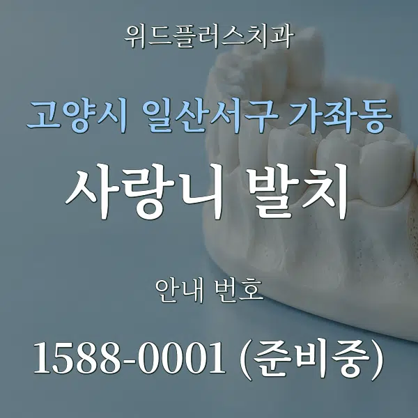 고양시 일산서구 가좌동 사랑니 발치 대표 안내 그래픽