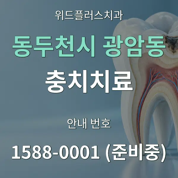 동두천시 광암동 충치치료 대표 안내 그래픽