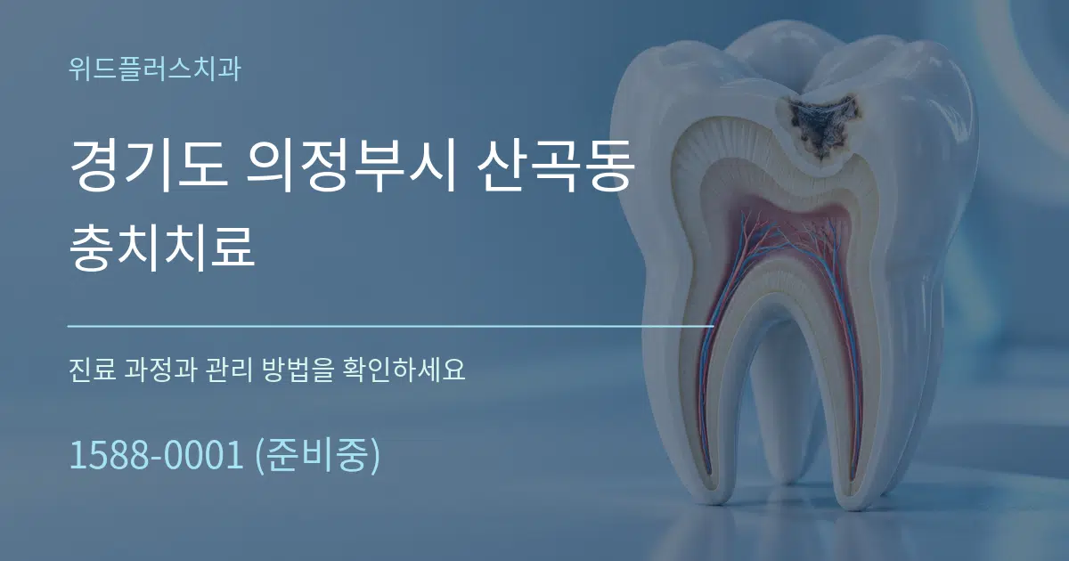 경기도 의정부시 산곡동 충치치료 서비스 이용 안내 그래픽