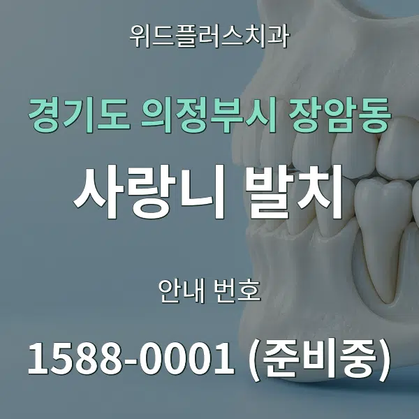 경기도 의정부시 장암동 사랑니 발치 대표 안내 그래픽