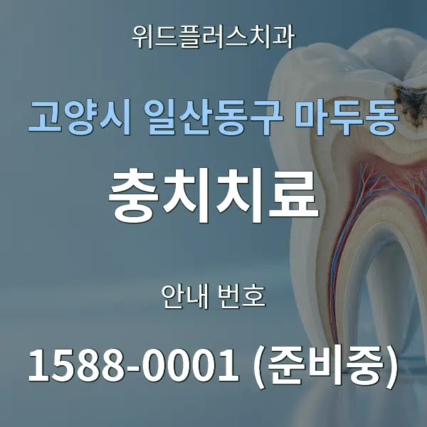 고양시 일산동구 마두동 충치치료 대표 안내 그래픽