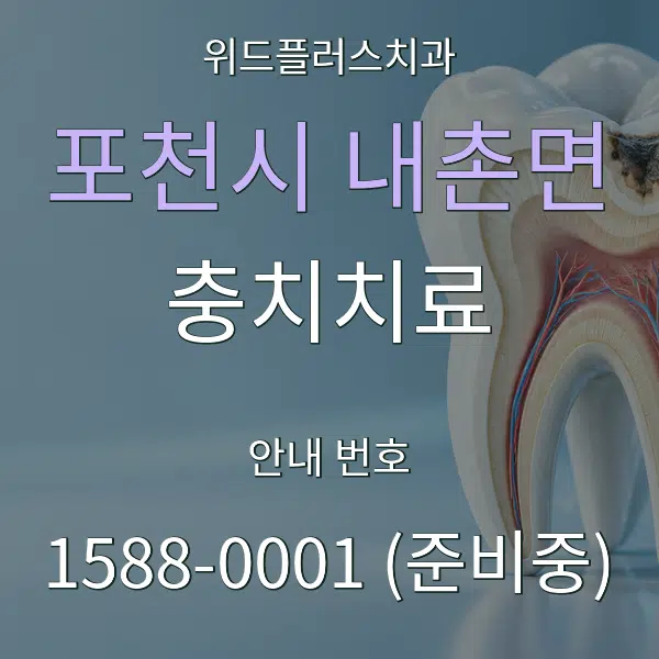 포천시 내촌면 충치치료 대표 안내 그래픽