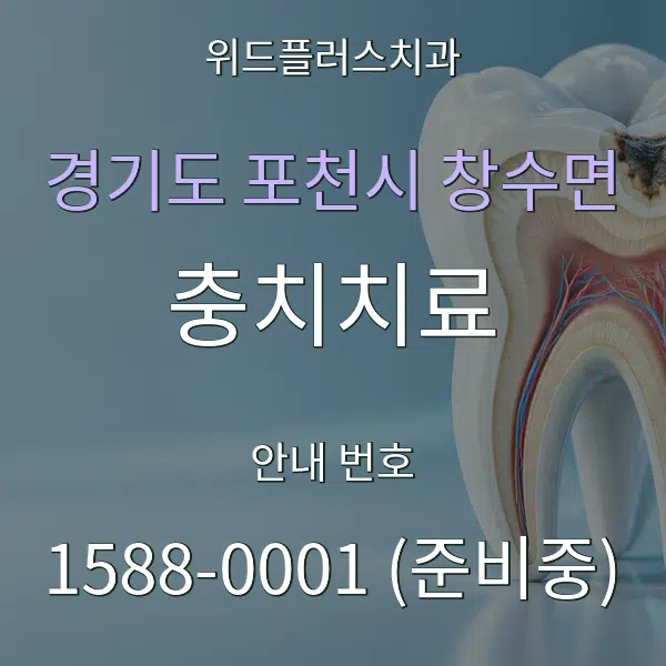 경기도 포천시 창수면 충치치료 대표 안내 그래픽