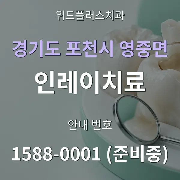 경기도 포천시 영중면 인레이치료 대표 안내 그래픽