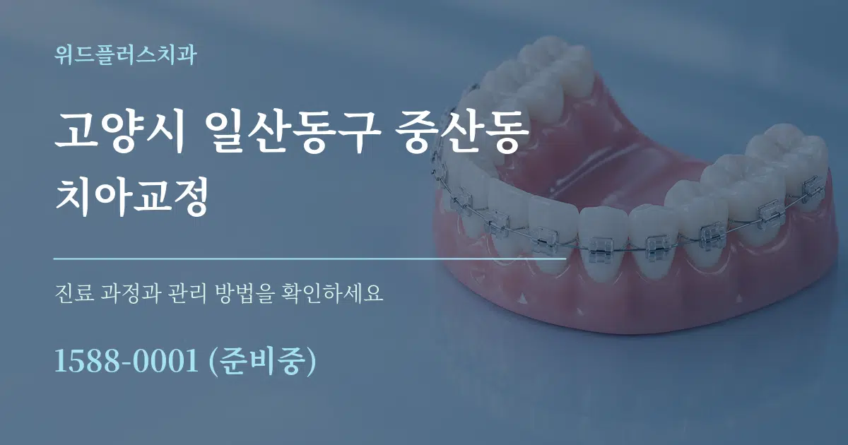 고양시 일산동구 중산동 치아교정 서비스 이용 안내 그래픽