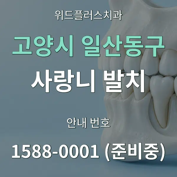 고양시 일산동구 사랑니 발치 대표 안내 그래픽
