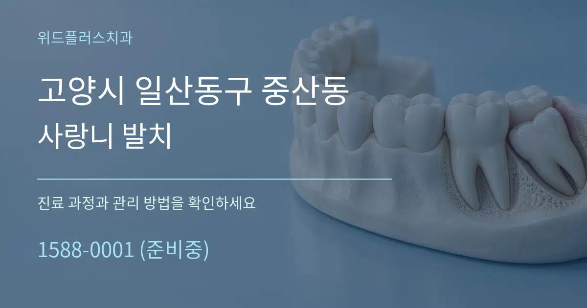 고양시 일산동구 중산동 사랑니 발치 서비스 이용 안내 그래픽
