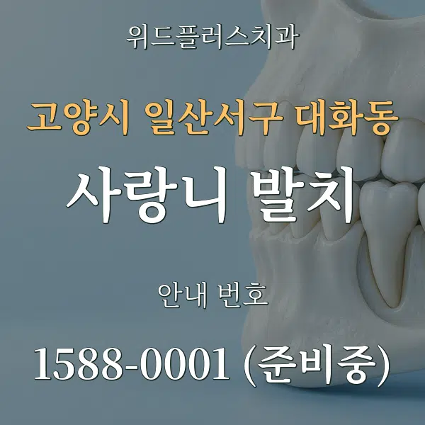 고양시 일산서구 대화동 사랑니 발치 대표 안내 그래픽