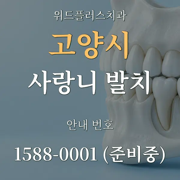 고양시 사랑니 발치 대표 안내 그래픽