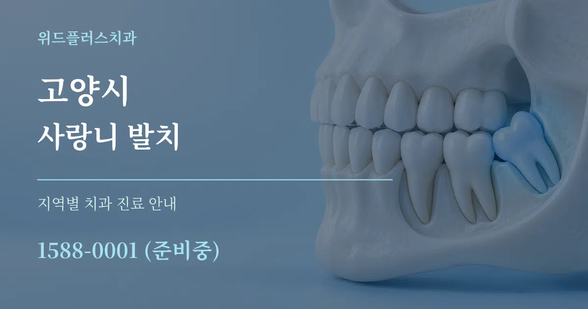 고양시 사랑니 발치 대표 안내 그래픽