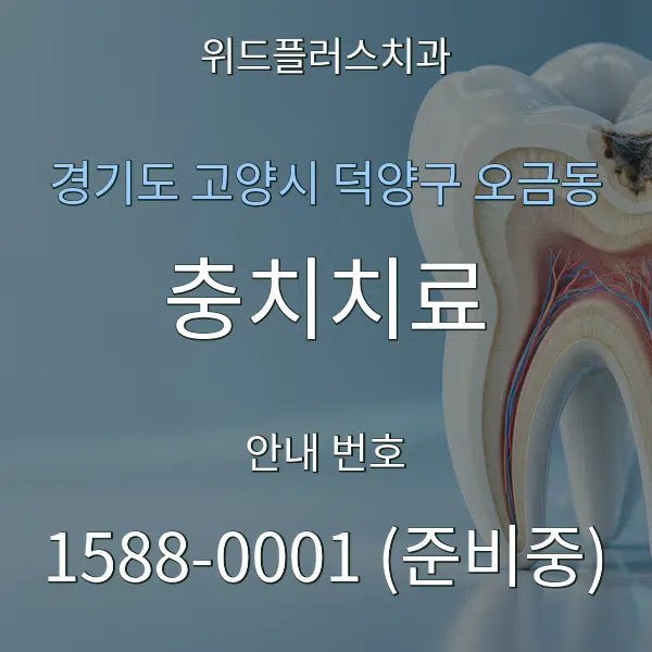 경기도 고양시 덕양구 오금동 충치치료 대표 안내 그래픽