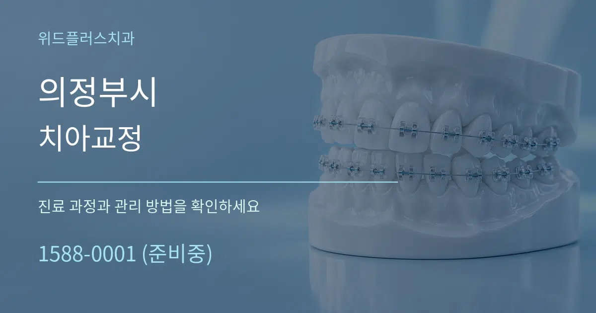 의정부시 치아교정 작업 조건 안내 그래픽