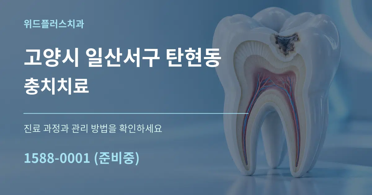 고양시 일산서구 탄현동 충치치료 작업 조건 안내 그래픽