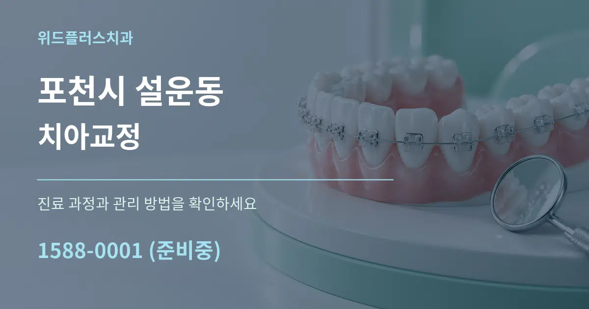 포천시 설운동 치아교정 서비스 이용 안내 그래픽