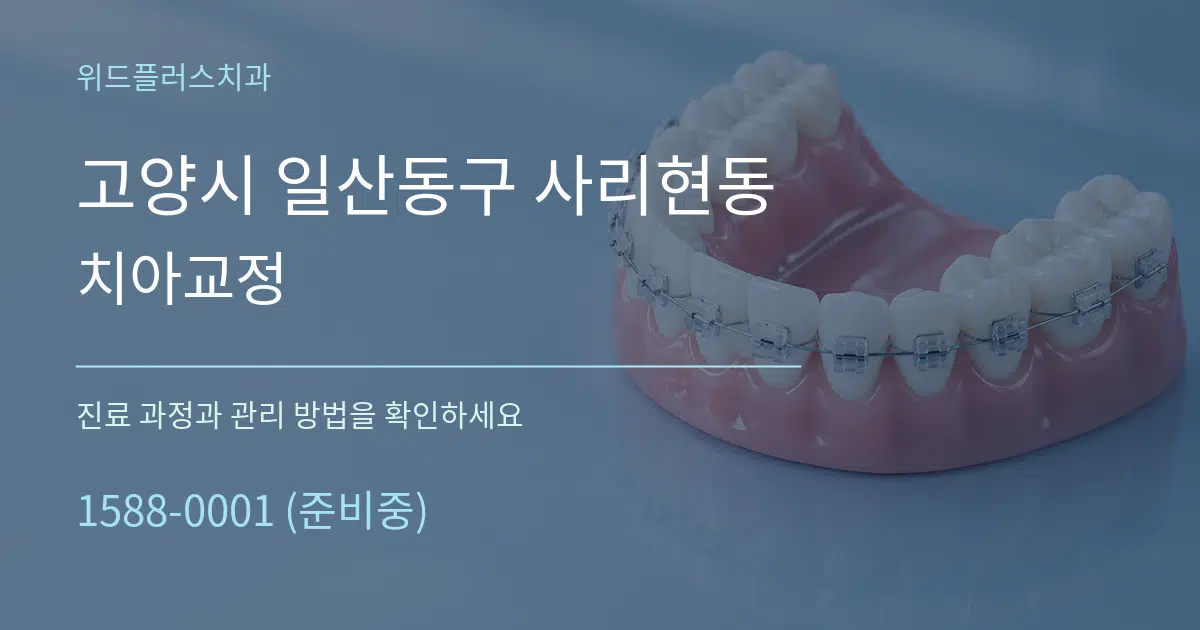 고양시 일산동구 사리현동 치아교정 작업 조건 안내 그래픽