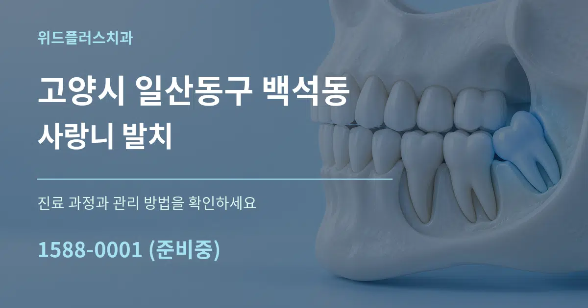고양시 일산동구 백석동 사랑니 발치 서비스 이용 안내 그래픽