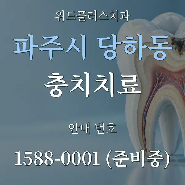 파주시 당하동 충치치료 대표 안내 그래픽