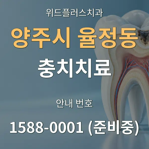 양주시 율정동 충치치료 대표 안내 그래픽