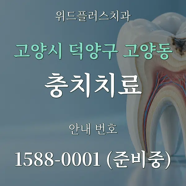 고양시 덕양구 고양동 충치치료 대표 안내 그래픽
