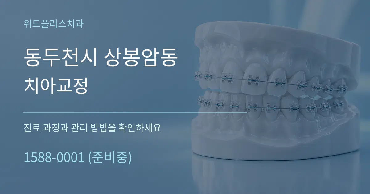 동두천시 상봉암동 치아교정 작업 조건 안내 그래픽
