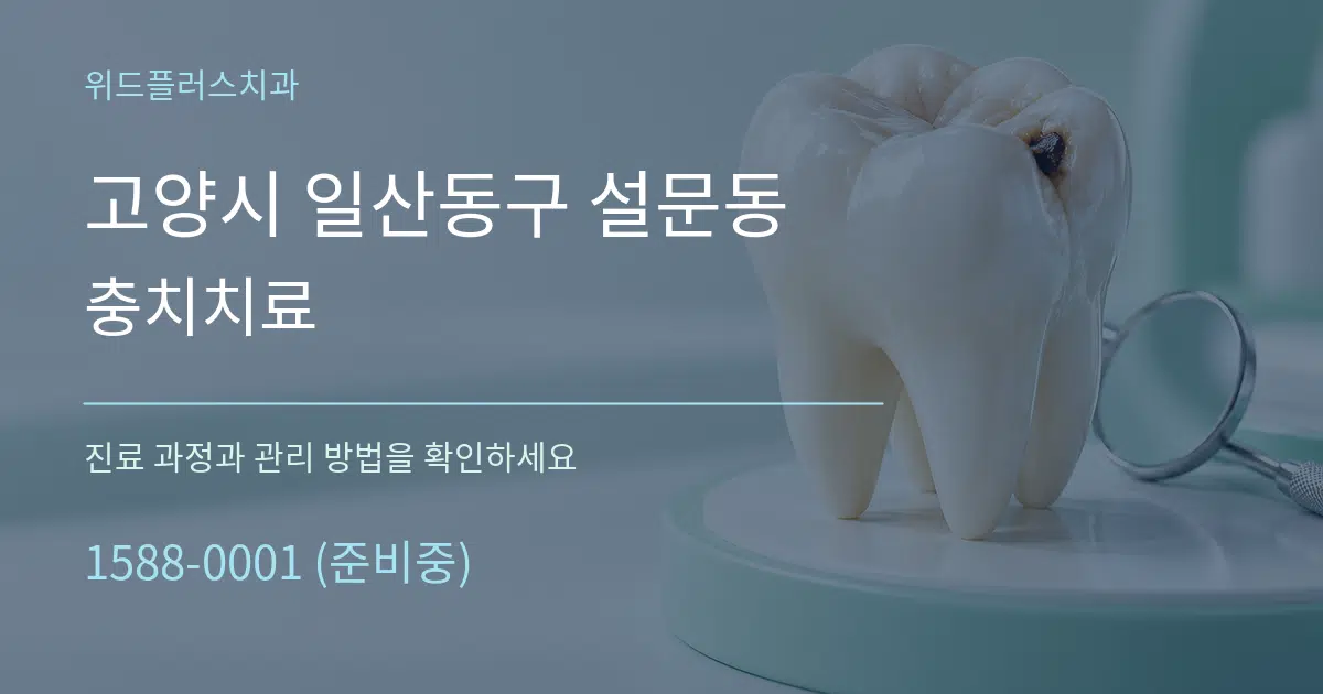 고양시 일산동구 설문동 충치치료 작업 조건 안내 그래픽