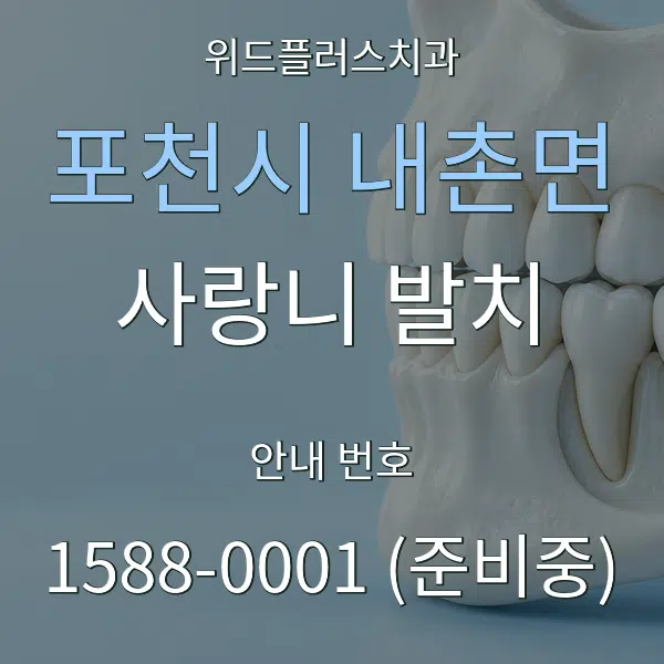 포천시 내촌면 사랑니 발치 대표 안내 그래픽