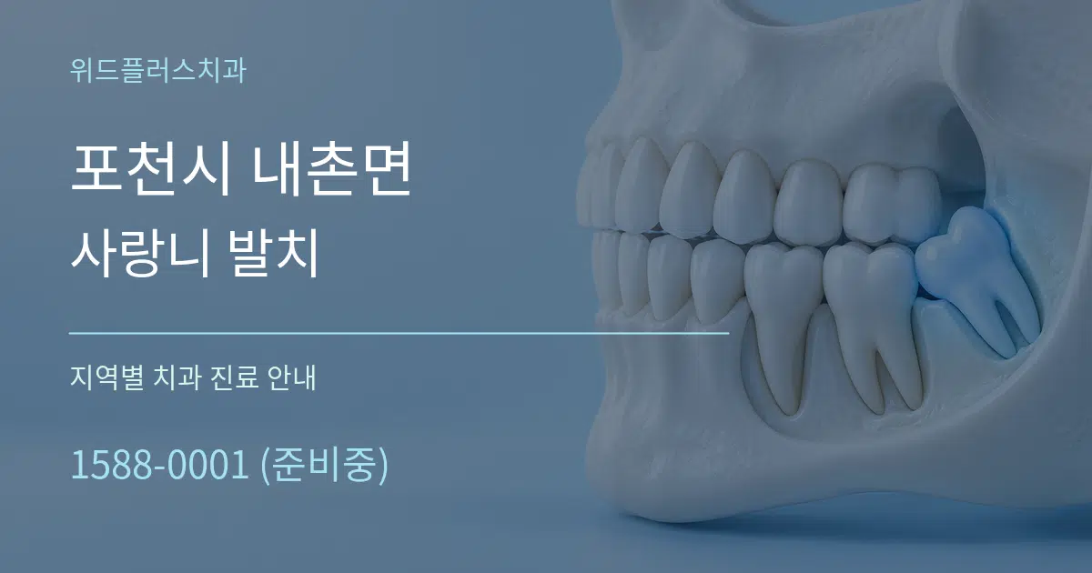포천시 내촌면 사랑니 발치 대표 안내 그래픽
