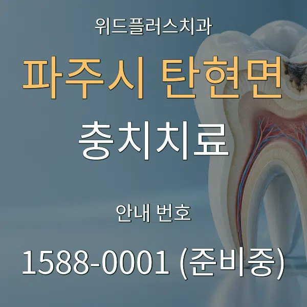 파주시 탄현면 충치치료 대표 안내 그래픽