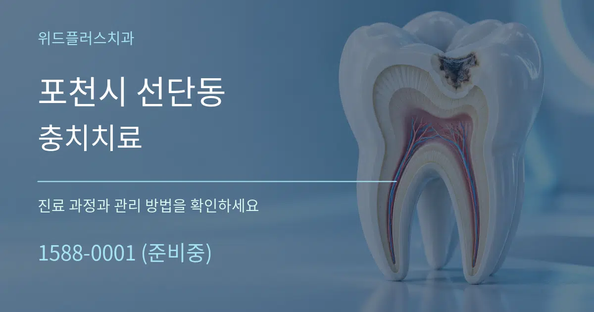 포천시 선단동 충치치료 서비스 이용 안내 그래픽