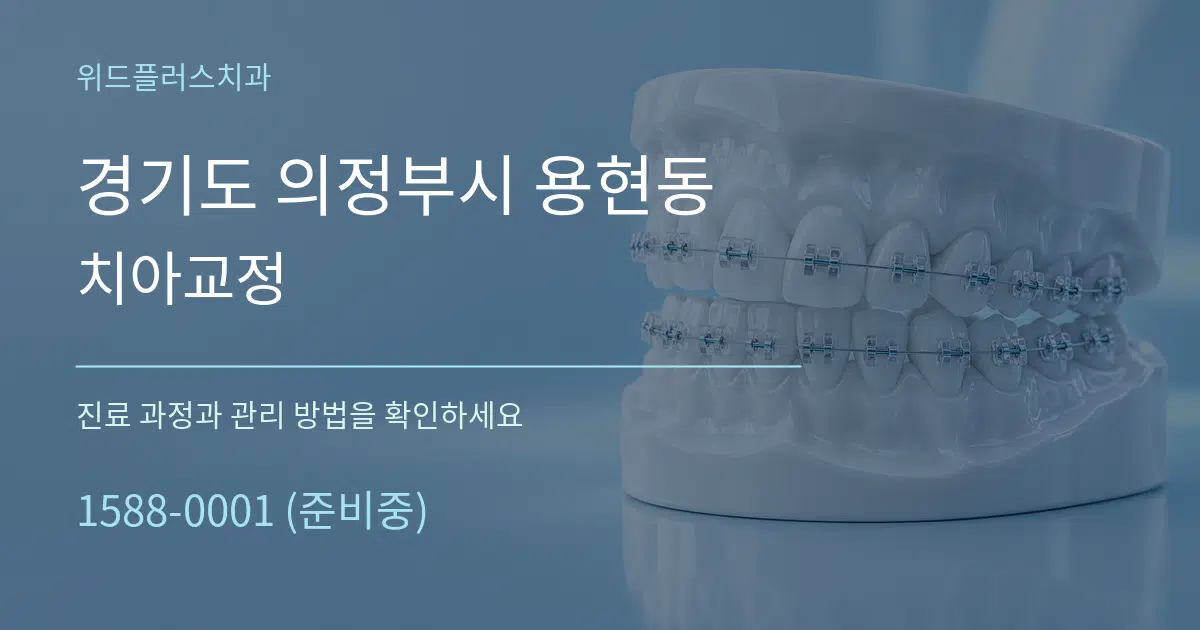 경기도 의정부시 용현동 치아교정 작업 조건 안내 그래픽