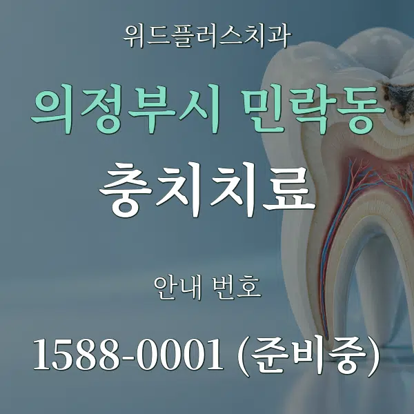 의정부시 민락동 충치치료 대표 안내 그래픽