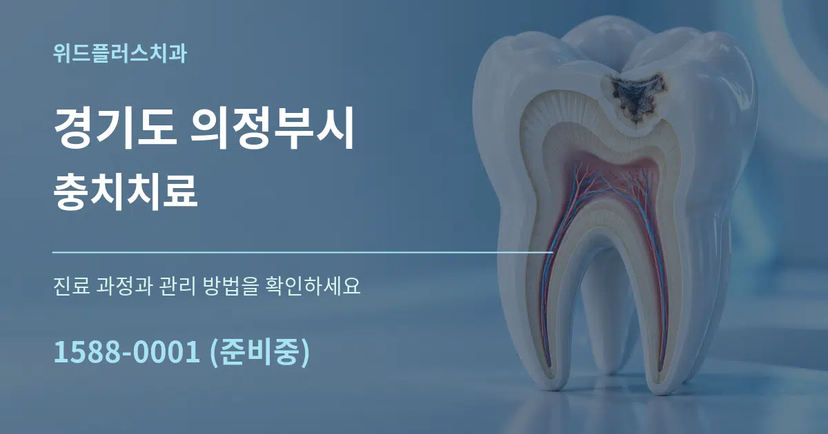 경기도 의정부시 충치치료 작업 조건 안내 그래픽