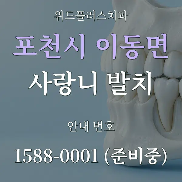 포천시 이동면 사랑니 발치 대표 안내 그래픽