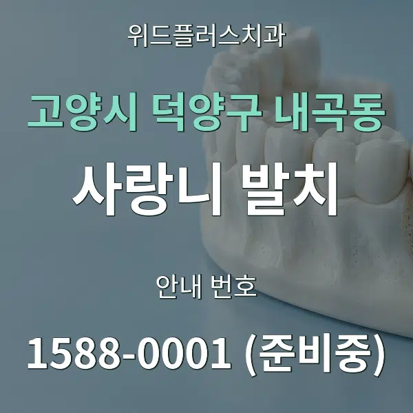 고양시 덕양구 내곡동 사랑니 발치 대표 안내 그래픽