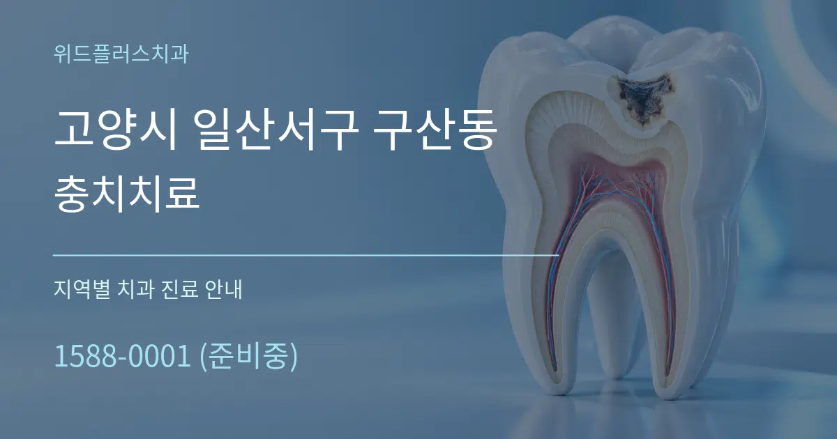 고양시 일산서구 구산동 충치치료 대표 안내 그래픽