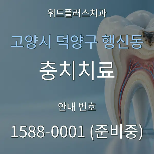 고양시 덕양구 행신동 충치치료 대표 안내 그래픽