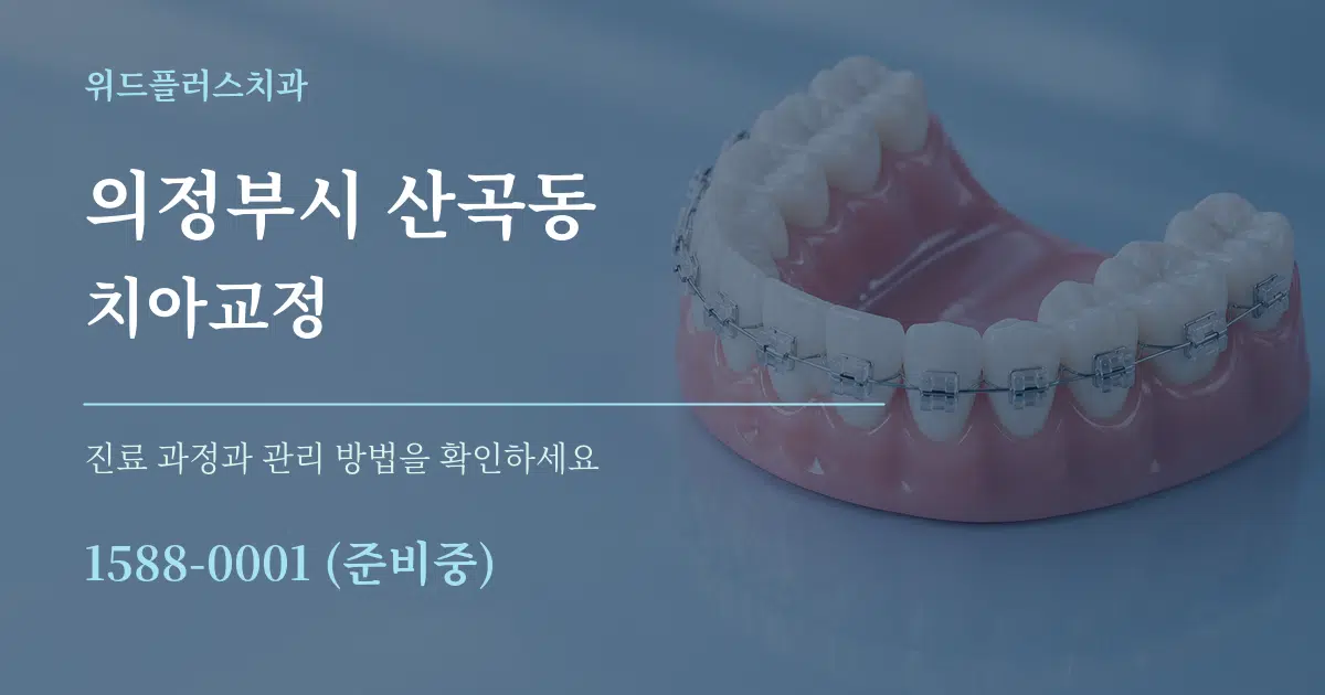 의정부시 산곡동 치아교정 작업 조건 안내 그래픽