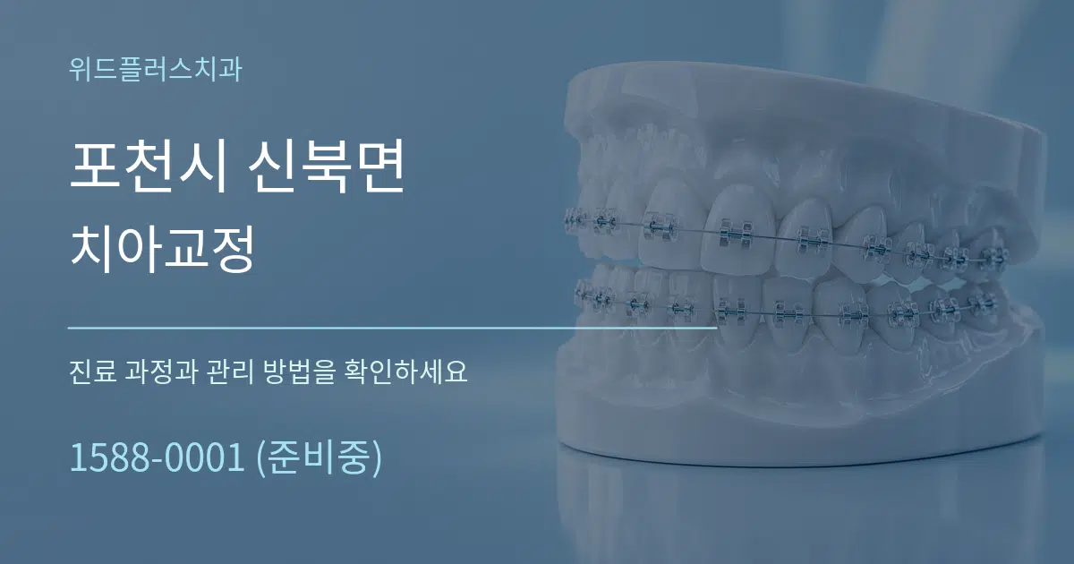 포천시 신북면 치아교정 작업 조건 안내 그래픽
