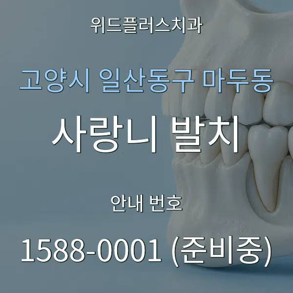 고양시 일산동구 마두동 사랑니 발치 대표 안내 그래픽