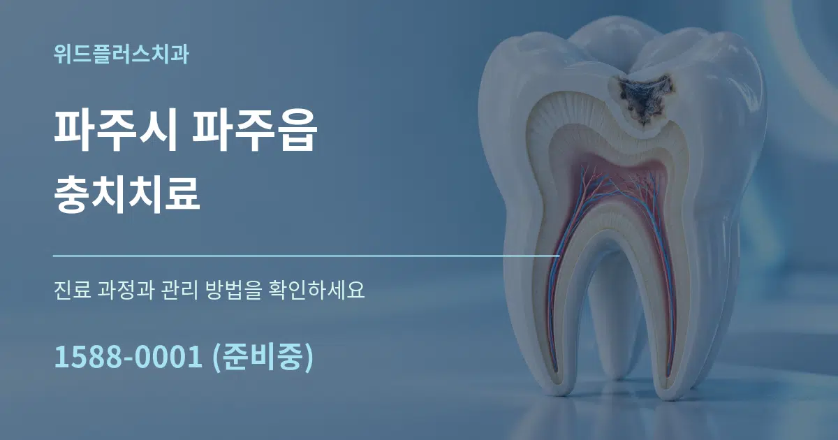 파주시 파주읍 충치치료 작업 조건 안내 그래픽