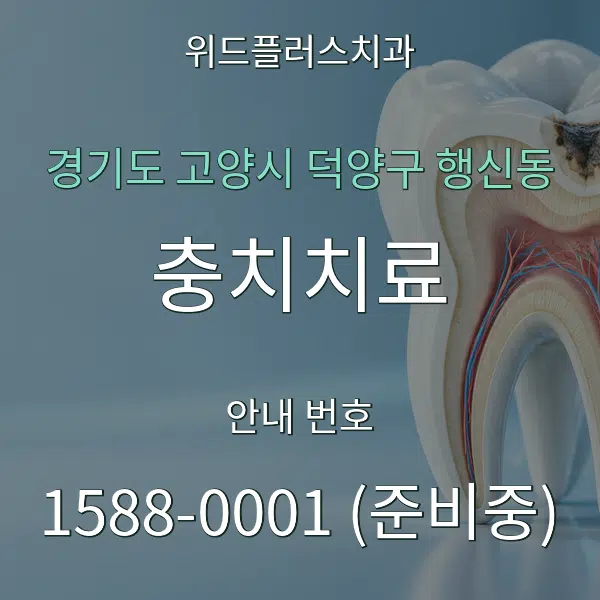 경기도 고양시 덕양구 행신동 충치치료 대표 안내 그래픽
