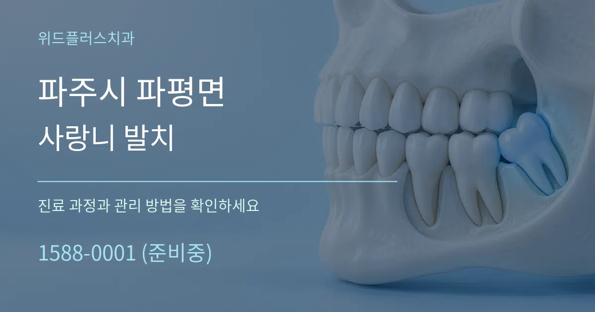 파주시 파평면 사랑니 발치 작업 조건 안내 그래픽