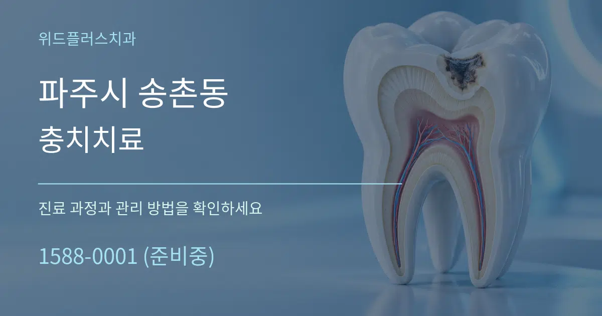 파주시 송촌동 충치치료 작업 조건 안내 그래픽